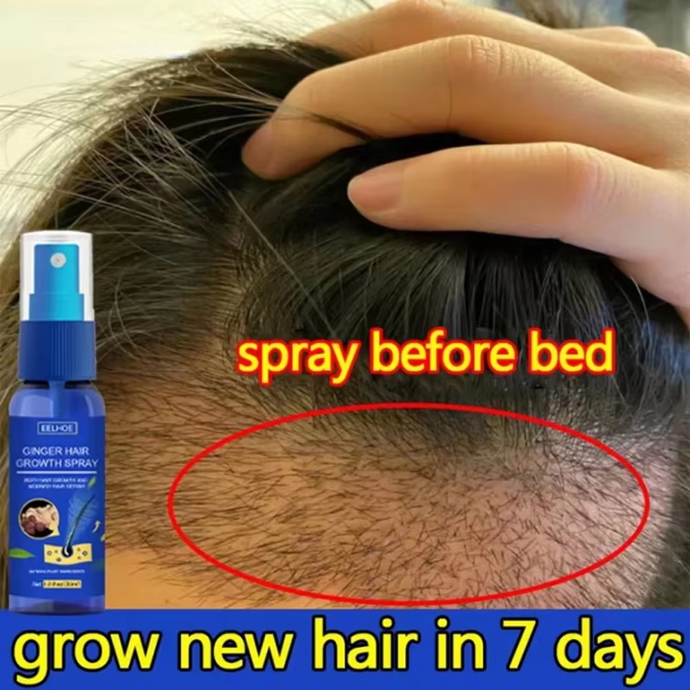 Hair Care Serum - 速効性ジンジャーヘアグローススプレー、毛根育成、脱毛防止、育毛セラム、頭皮ダメージ修復、栄養ケア製品、女性男性用