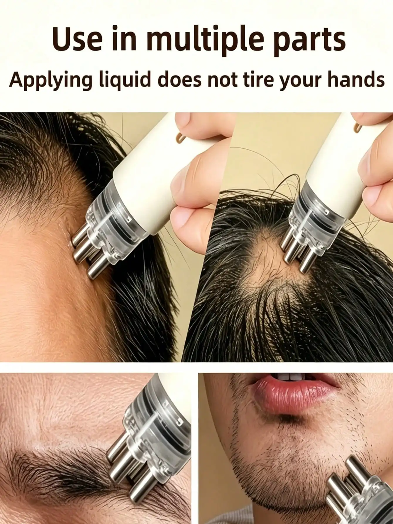 Hair Care Serum - 頭皮アプリケーター トラベルキャパシティヘアグロースセラムガイドコームローラーボールアプリケーター、ポータブル頭皮アプリケーターコーム、速度調整可能なヘアケアマッサージコーム、頭皮マッサージツール、頭皮を滑らかにする、プロのヘアスタイリングツール、適切なツール