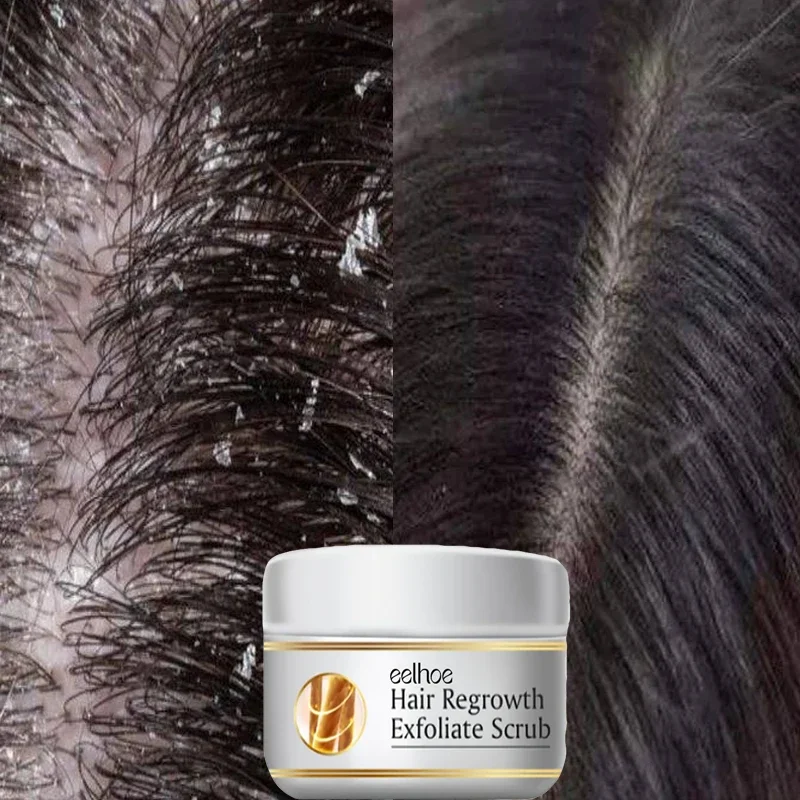 速効性フケ防止ヘアトリートメントスクラブ かゆみ止め頭皮洗浄 - Scalp Scrub Exfoliant のレビューと価格
