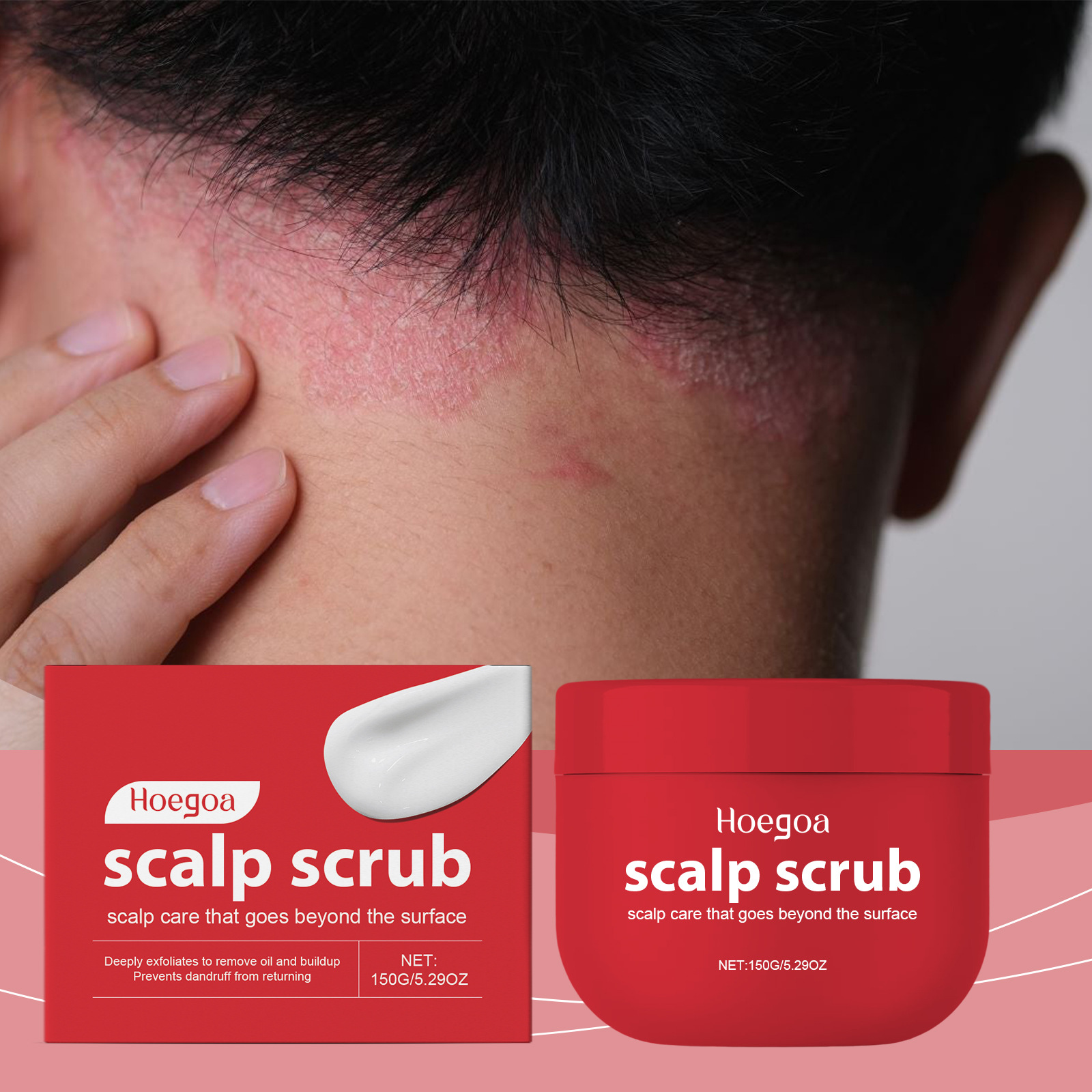 頭皮スクラブシャンプー オイルコントロール 乾燥除去 角質除 - Scalp Scrub Exfoliant のレビューと価格
